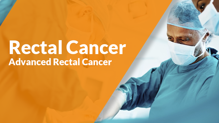 Advanced Rectal Cancer Ecancer