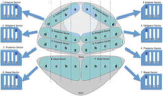 prostata ct1c