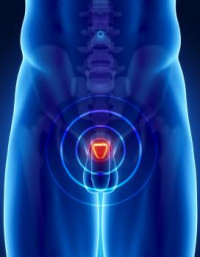 efectos de la terapia hormonal de próstata