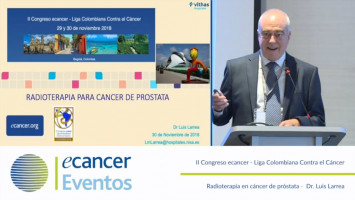 imágenes de radioterapia para el cáncer de próstata