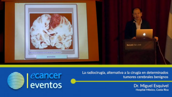 centros de radiocirugía para el cáncer de próstata en europar centros de radiocirugía para el cáncer de próstata en europar